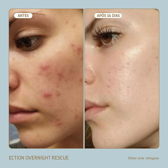 Hidratante Noturno Reparação Profunda Biossance SQUALANE ECTOIN OVERNIGHT RESCUE